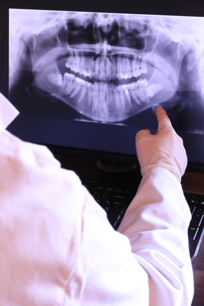 Best Emergency Wisdom Teeth Removal in Ranchettes, WY