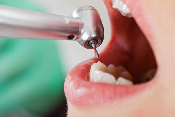 Best Emergency Dental Surgery in Ranchettes, WY
